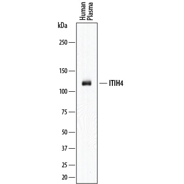 Detection of Human ITIH4 antibody by Western Blot.
