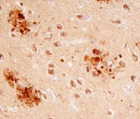 ITM2B antibody in Human Brain by Immunohistochemistry (IHC-P).