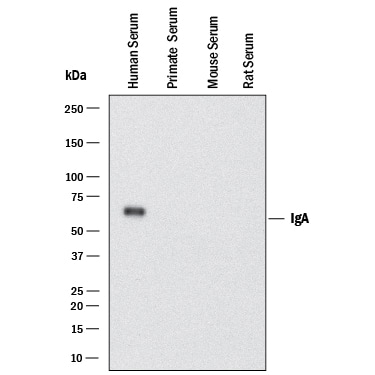 Detection of Human IgA antibody by Western Blot.