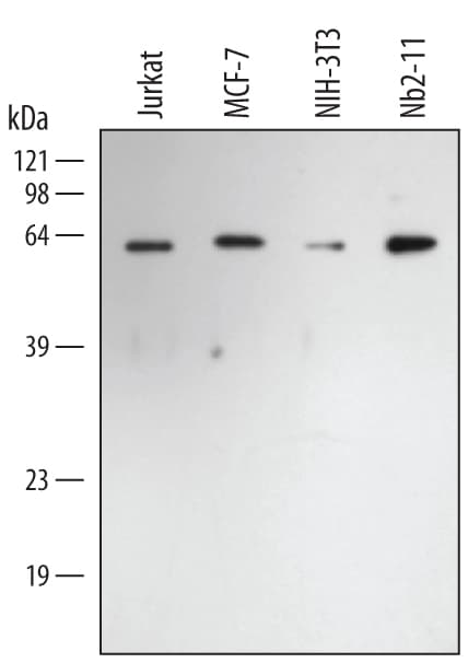 Detection of Rabbit IgG Primary Antibody by Western Blot