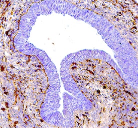 Detection of Phospho-p38 (T180/Y182) in Mouse Embryo (13 d.p.c.).