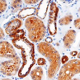 Detection of SKG in Human Kidney.