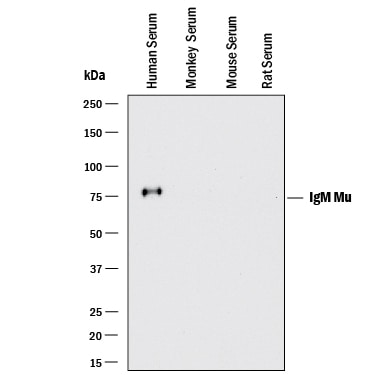 Detection of Human IgM antibody by Western Blot.
