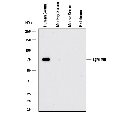 Detection of Human IgM antibody by Western Blot.