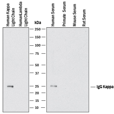 Detection of Human Ig Kappa Light Chain antibody by Western Blot.