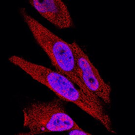 IkB-a antibody in HeLa Human Cell Line by Immunocytochemistry (ICC).