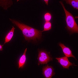 IkB-a antibody in HeLa Human Cell Line by Immunocytochemistry (ICC).