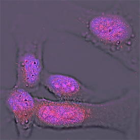 Importin  beta /KPNB1 antibody in HeLa Human Cell Line by Immunocytochemistry (ICC).