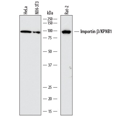Detection of Human, Mouse, and Rat Importin  beta /KPNB1 antibody by Western Blot.