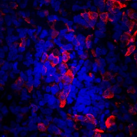 C-Peptide antibody in BG01V Human Embryonic Stem Cells by Immunocytochemistry (ICC).