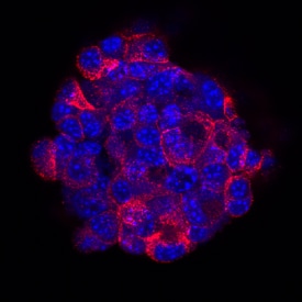 Insulin antibody in  beta TC-6 Mouse Cell Line by Immunocytochemistry (ICC).