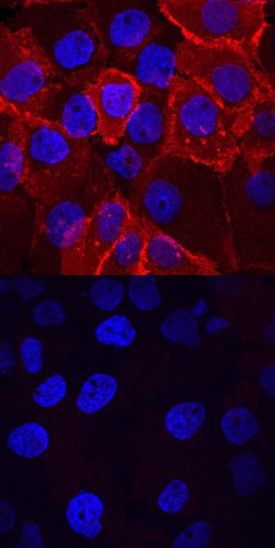 Phospho-Insulin R (Y1162/1163)/IGF-I R (Y1135/1136) antibody in A431 Human Cell Line by Immunocytochemistry (ICC).