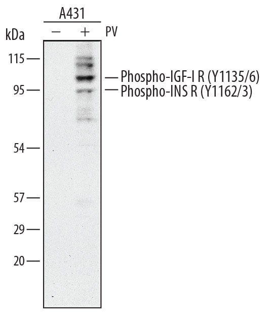 Detection of Human Phospho-Insulin R (Y1162/Y1163) and Phospho-IGF-I R (Y1135/1136) antibody by Western Blot.