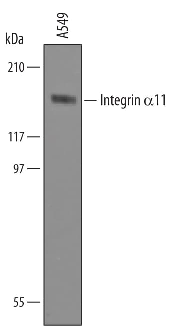 Detection of Human Integrin a11 antibody by Western Blot.