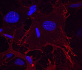 Integrin alpha 11 antibody in Mouse Embryonic Fibroblasts (iMEF) by Immunocytochemistry (ICC).