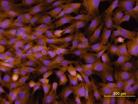 Integrin a2/CD49b antibody in MG-63 Human Cell Line by Immunocytochemistry (ICC).