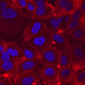 Integrin a8 antibody in H4 Human Cell Line by Immunocytochemistry (ICC).