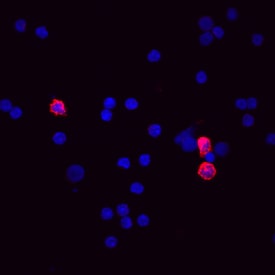 CD11b/Integrin aM antibody in Mouse Spleno-cytes by Immunocytochemistry (ICC).