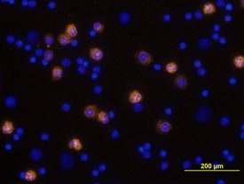 CD11b/Integrin aM antibody in Mouse Splenocytes by Immunocytochemistry (ICC).