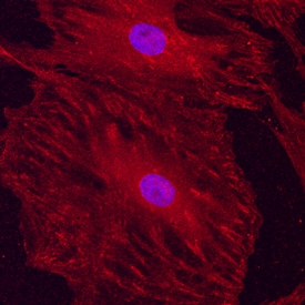Integrin aV/CD51 antibody in Rat Mesenchymal Stem Cells by Immunocytochemistry (ICC).