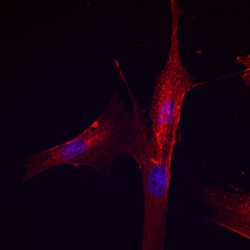 Integrin  beta 1/CD29 antibody in Canine Mesenchymal Stem Cells by Immunocytochemistry (ICC).