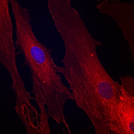 Integrin  beta 1/CD29 antibody in Human Mesenchymal Stem Cells by Immunocytochemistry (ICC).