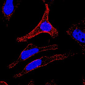 Integrin  beta 1/CD29 antibody in HeLa Human Cell Line by Immunocytochemistry (ICC).