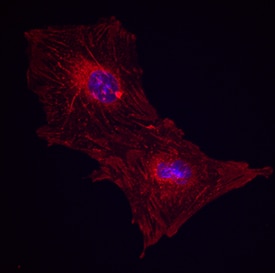 Integrin  beta 1/CD29 antibody in Porcine Mesenchymal Stem Cells by Immunocytochemistry (ICC).