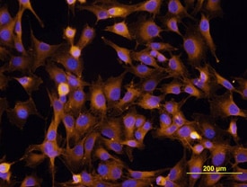 Integrin  beta 1/CD29 antibody in MG-63 Human Cell Line by Immunocytochemistry (ICC).
