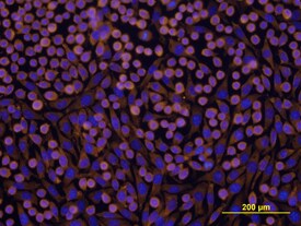Integrin  beta 1/CD29 antibody in L-929 Mouse Cell Line by Immunocytochemistry (ICC).