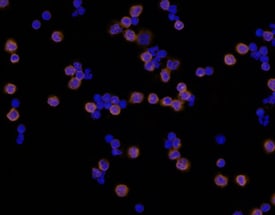 Integrin  beta 2/CD18 antibody in Human PBMCs by Immunocytochemistry (ICC).