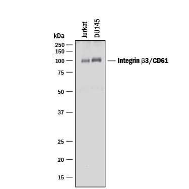Detection of Human Integrin  beta 3/CD61 antibody by Western Blot.