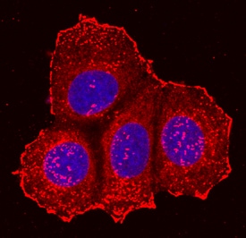 Integrin  beta 5 antibody in MCF-7 Human Cell Line by Immunocytochemistry (ICC).