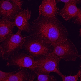 Integrin aV beta 5 antibody in HT1080 Human Cell Line by Immunocytochemistry (ICC).