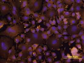 Integrin  beta 6 antibody in XB2 Mouse Cell Line by Immunocytochemistry (ICC).