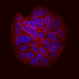 Integrin  beta 6 antibody in HT-29 Human Cell Line by Immunocytochemistry (ICC).