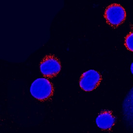 Integrin  beta 7 antibody in Human PBMCs by Immunocytochemistry (ICC).