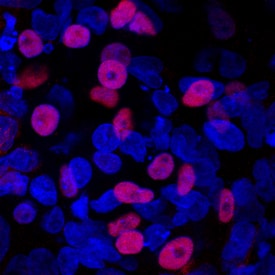 Islet-1 antibody in iPS2 Human Stem Cells by Immunocytochemistry (ICC).