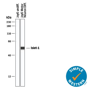 Detection of Human Islet-1 antibody by Simple WesternTM.