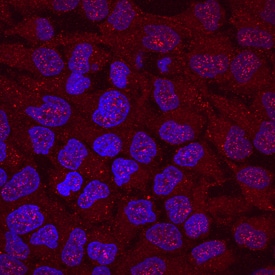 Jade-1/PHF17 antibody in HeLa Human Cell Line by Immunocytochemistry (ICC).