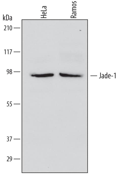 Detection of Human Jade-1/PHF17 antibody by Western Blot.