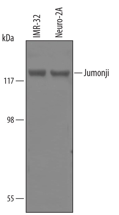 Detection of Human Jumonji/JARID2 antibody by Western Blot.
