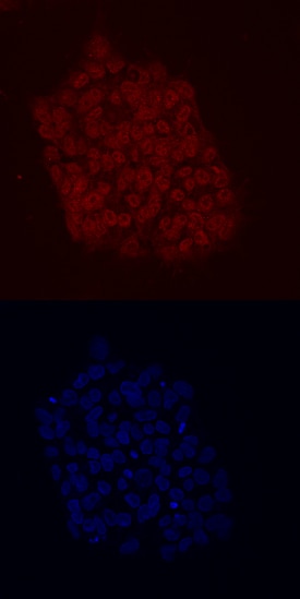 KLF2 antibody in BG01V Human Cells by Immunocytochemistry (ICC).