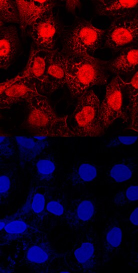 Importin a2/KPNA2 antibody in NTera-2 Human Cell Line by Immunocytochemistry (ICC).
