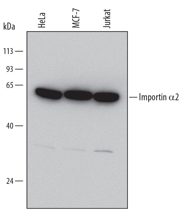 Detection of Human Importin a2/KPNA2 antibody by Western Blot.