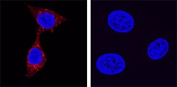 Kallikrein 3/PSA antibody in LNCaP and MCF-7 Human Cell Lines by Immunocytochemistry (ICC).
