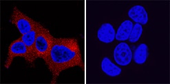 Kallikrein 3/PSA antibody in LNCaP and MCF-7 Human Cell Lines by Immunocytochemistry (ICC).