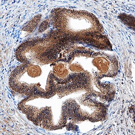 Kallikrein 3/PSA antibody in Human Prostate by Immunohistochemistry (IHC-P).