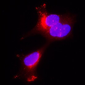 Kallikrein 3/PSA antibody in LNCaP Human Cell Line by Immunocytochemistry (ICC).