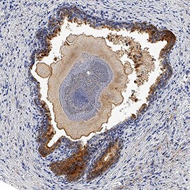 Kallikrein 3/PSA antibody in Human Prostate by Immunohistochemistry (IHC-P).